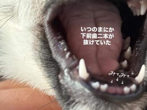 下の歯が2本、抜けてた！