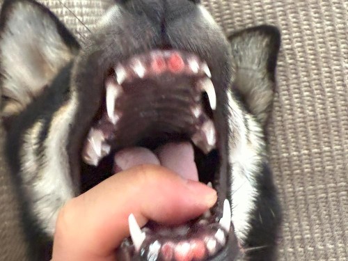 さらに歯が抜けているよ！